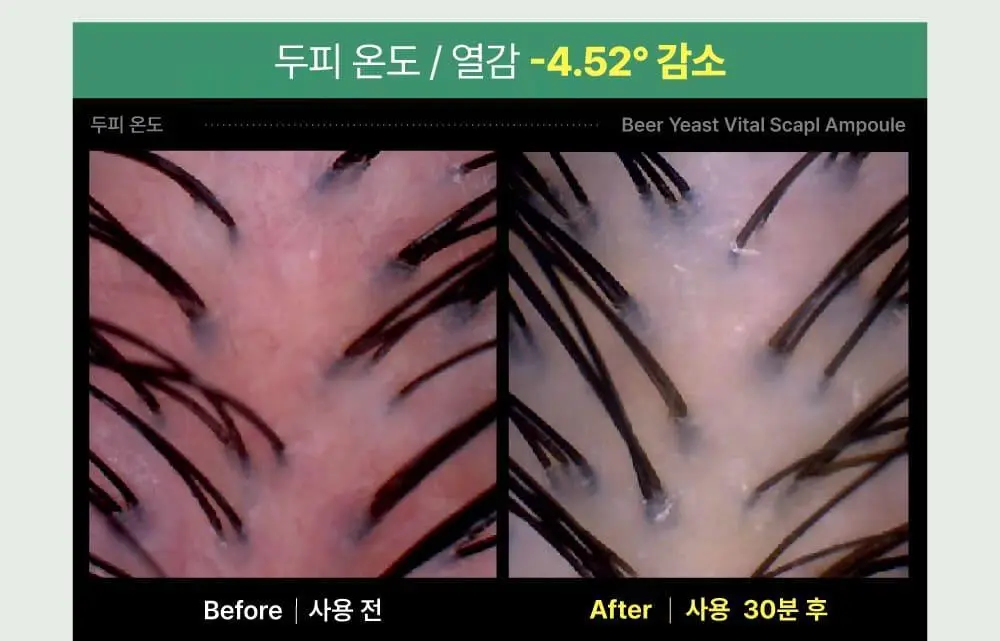 [5종임상완료/4주탈모케어] 애쉬로렌 맥주효모 바이탈 스칼프 앰플 100ml 상세페이지 39